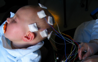 The image depicts a young child undergoing an EEG (electroencephalogram) procedure. The child is resting with several electrodes attached to their scalp using adhesive pads. Thin wires connect the electrodes to the recording equipment, and the child appears to be comfortably seated or reclined.